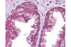 Immunohistochemistry (IHC) image for anti-Signal Transducer and Activator of Transcription 6, Interleukin-4 Induced (STAT6) (C-Term) antibody (ABIN486817) (STAT6 antibody  (C-Term))