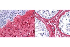 Immunohistochemistry (IHC) image for anti-Collagen, Type III, alpha 1 (COL3A1) antibody (ABIN5596830)