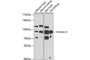 Western blot analysis of extracts of various cell lines, using PCDH antibody (ABIN6129639, ABIN6145299, ABIN6145300 and ABIN6223365) at 1:1000 dilution. (PCDHa13 antibody  (AA 300-360))