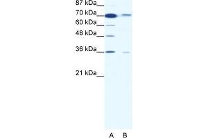 WB Suggested Anti-SMAD4 Antibody Titration:  1. (SMAD4 antibody  (Middle Region))