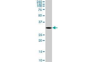 DECR2 monoclonal antibody (M03), clone 4A7. (DECR2 antibody  (AA 49-109))