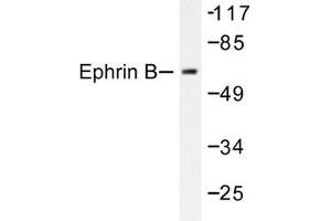Image no. 1 for anti-Ephrin B1 (EFNB1) antibody (ABIN271886)