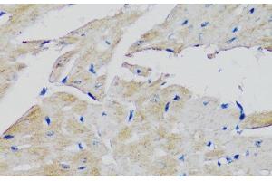 Immunohistochemistry of paraffin-embedded Mouse heart using FGFR2 Polyclonal Antibody at dilution of 1:100 (40x lens). (FGFR2 antibody)