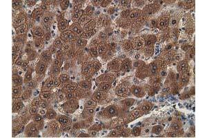 Image no. 8 for anti-Alcohol Dehydrogenase 1B (Class I), beta Polypeptide (ADH1B) antibody (ABIN1496477)