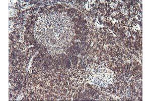 Immunohistochemical staining of paraffin-embedded Human tonsil using anti-PDLIM2 mouse monoclonal antibody. (PDLIM2 antibody)