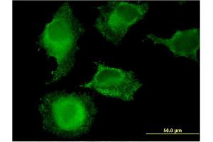 Immunofluorescence (IF) image for anti-Membrane-Associated Ring Finger (C3HC4) 9 (MARCH9) (AA 240-345) antibody (ABIN530125)