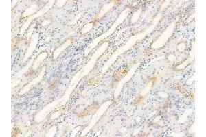 ABIN6260836 and ABIN6266727 at 1/100 staining human normal kidney tissue by IHC-P.