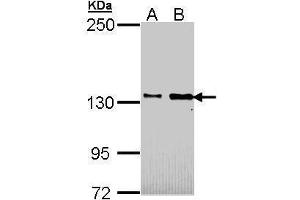 WB Image Sample (30 ug of whole cell lysate) A: H1299 B: Hela 5% SDS PAGE antibody diluted at 1:1000 (CDON antibody  (N-Term))