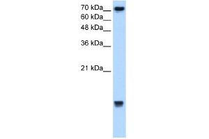 WB Suggested Anti-UBE2N Antibody Titration:  2. (UBE2N antibody  (Middle Region))