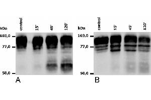 Western blotting analysis of PMA-activated neutrophils (A) and monocytes (B), using anti-human CD18 (MEM-148). (Integrin beta 2 antibody)