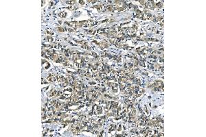 IHC analysis of ASS1 using anti-ASS1 antibody (ABIN7601191). (ASS1 antibody  (AA 3-365))