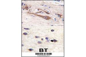 Formalin-fixed and paraffin-embedded human brain tissue reacted with VILIP1 antibody (C-term ), which was peroxidase-conjugated to the secondary antibody, followed by DAB staining. (VSNL1 antibody  (C-Term))