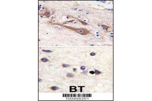 Formalin-fixed and paraffin-embedded human brain tissue reacted with VILIP1 antibody (C-term ), which was peroxidase-conjugated to the secondary antibody, followed by DAB staining.