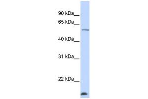 WB Suggested Anti-WDR40A Antibody Titration:  0. (DCAF12 antibody  (N-Term))