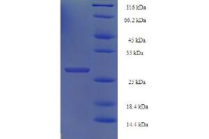 HIST1H2BN Protein (AA 2-126) (His-SUMO Tag)
