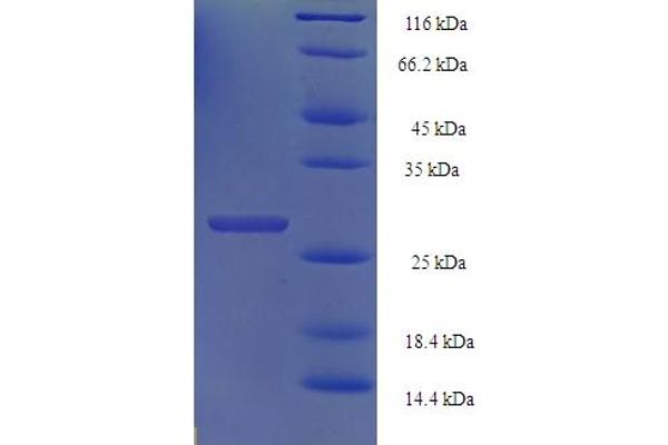 HIST1H2BN Protein (AA 2-126) (His-SUMO Tag)