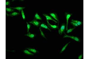 Immunofluorescence staining of Hela cells with ABIN7165980 at 1:133, counter-stained with DAPI. (SSH3 antibody  (AA 480-659))