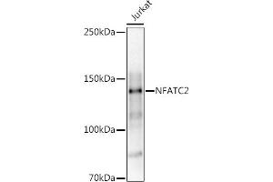 Western blot analysis of extracts of Jurkat cells, using (ABIN3017384, ABIN3017385, ABIN3017386 and ABIN6220063) at 1:1000 dilution. (NFAT1 antibody)