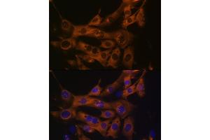 Immunofluorescence (IF) image for anti-Fatty Acid Synthase (FASN) antibody (ABIN7267157)
