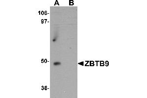 Western Blotting (WB) image for anti-Zinc Finger and BTB Domain Containing 9 (ZBTB9) (C-Term) antibody (ABIN1030815) (ZBTB9 antibody  (C-Term))