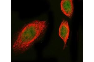 IF analysis of PROX1 using anti-SGT1/ECD antibody (ABIN7601937) and anti-Tubulin Alpha antibody (ABIN7600339).