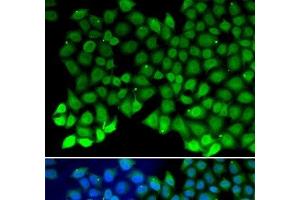 Immunofluorescence analysis of MCF-7 cells using RPA1 Polyclonal Antibody (RPA1 antibody)