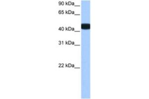 Western Blotting (WB) image for anti-Branched Chain Ketoacid Dehydrogenase Kinase (BCKDK) antibody (ABIN2463496) (BCKDK antibody)