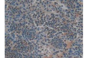 IHC-P analysis of Rat Lung Tissue, with DAB staining.