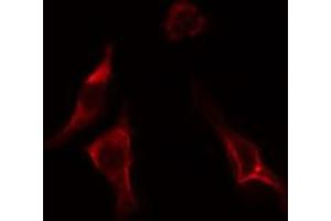 ABIN6274551 staining LOVO cells by IF/ICC. (ERGIC3 antibody  (C-Term))