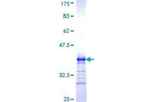 Image no. 1 for Serotonin Receptor 1B (HTR1B) (AA 1-49) protein (GST tag) (ABIN1307259) (5HT1B Receptor Protein (AA 1-49) (GST tag))
