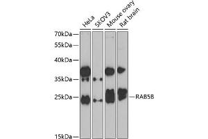 Western blot analysis of extracts of various cell lines, using RB antibody (ABIN6128601, ABIN6146597, ABIN6146598 and ABIN6223325) at 1:1000 dilution. (RAB5B antibody  (AA 1-215))