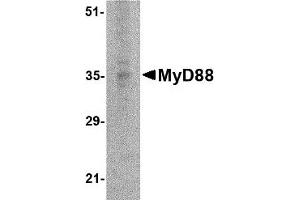 Western Blotting (WB) image for anti-Myeloid Differentiation Primary Response Gene (88) (MYD88) antibody (ABIN1031779) (MYD88 antibody)