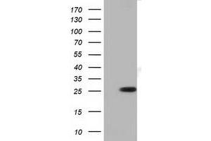 HEK293T cells were transfected with the pCMV6-ENTRY control (Left lane) or pCMV6-ENTRY RND1 (Right lane) cDNA for 48 hrs and lysed. (RND1 antibody)