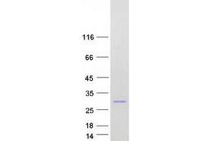 Validation with Western Blot (CBX1 Protein (Transcript Variant 2) (Myc-DYKDDDDK Tag))