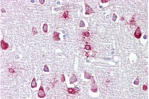 Immunohistochemistry with Brain, cortex tissue at an antibody concentration of 5µg/ml using anti-PPME1 antibody (ARP56845_P050) (PPME1 antibody  (N-Term))