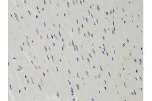 Immunohistochemistry of paraffin-embedded rat heart using LMNB1 antibody (ABIN5970980) at dilution of 1/100 (40x lens). (Lamin B1 antibody)