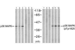 Western blot analysis of extracts from NIH-3T3 (Line 1, 4, 7 and 10) and COS7 (Line 2, 5, 8 and 11 and K562 (Line 3, 6, 9 and 12) cells, untreated or treated with (MAPK14 antibody)