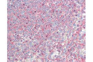 Human Spleen: Formalin-Fixed, Paraffin-Embedded (FFPE) (MTCL1 / SOGA2 antibody  (AA 13-202))