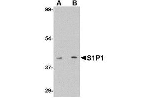 Image no. 1 for anti-Sphingosine-1-Phosphate Receptor 1 (S1PR1) (C-Term) antibody (ABIN342723) (S1PR1 antibody  (C-Term))