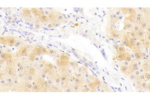 Detection of SAA2 in Human Liver Tissue using Polyclonal Antibody to Serum Amyloid A2 (SAA2) (SAA2 antibody  (AA 19-122))