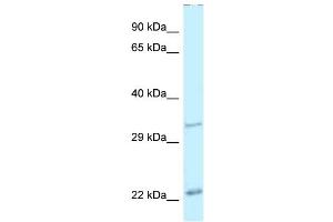 WB Suggested Anti-Pdx1 Antibody Titration: 1. (PDX1 antibody  (N-Term))