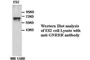 Image no. 1 for anti-Gonadotropin-Releasing Hormone Receptor (GNRHR) antibody (ABIN791149)