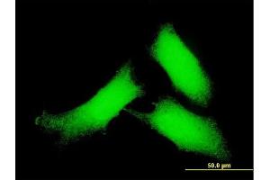Immunofluorescence of monoclonal antibody to CAMK2D on HeLa cell. (CAMK2D antibody  (AA 301-410))