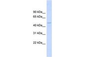Image no. 1 for anti-Drebrin-Like (DBNL) (AA 251-300) antibody (ABIN6743772) (DBNL antibody  (AA 251-300))