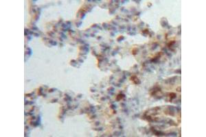 Used in DAB staining on fromalin fixed paraffin-embedded Lung tissue (ADAMTS8 antibody  (AA 832-889))