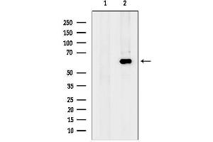 Western blot analysis of lysates from MDA-M, using Glypican4 Antibody.