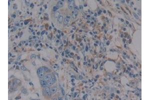 Immunohistochemistry (IHC) image for anti-Glutathione Peroxidase 1 (GPX1) (AA 50-203) antibody (ABIN7431530)