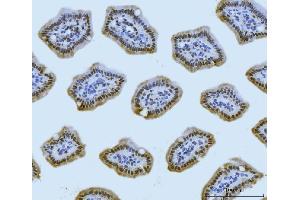 IHC analysis of MRE11 using anti-MRE11 antibody (ABIN7600025). (Mre11 antibody  (AA 14-481))