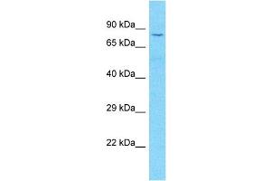 Host:  Rabbit  Target Name:  LONRF1  Sample Type:  Lymph Node Tumor lysates  Antibody Dilution:  1.