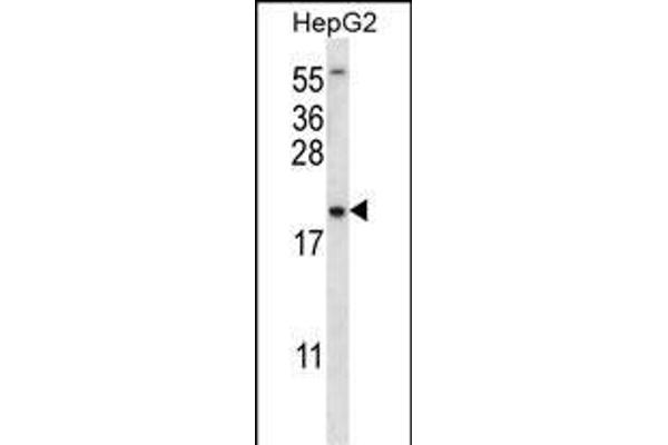 UBE2NL Antikörper  (N-Term)